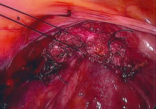 The vault is closed carefully